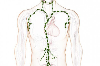 Lymphdrüsenkrebs - Ursachen, Symptome und Behandlung