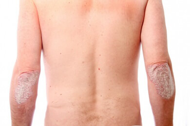 Dermatologie - Bereiche, Behandlungen und Einrichtungen