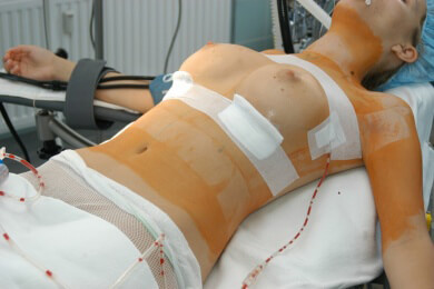 Plastische Chirurgie - Bereiche und Behandlungen