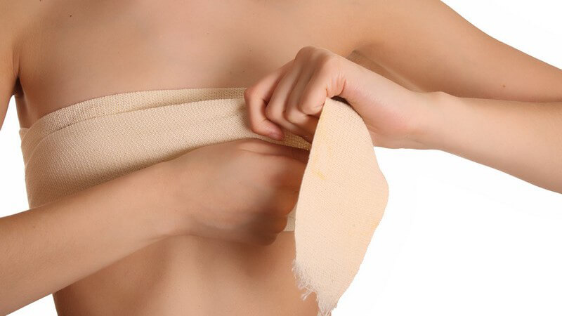 Als Bruststraffung oder Mastopexie bezeichnet man einen chirurgischen Eingriff, um erschlaffte und hängende Brüste anzuheben