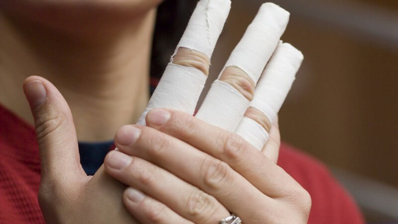 Zu den Fehlstellungen der Hand zählen z.B. fehlende oder mehr Finger oder auch Formveränderungen