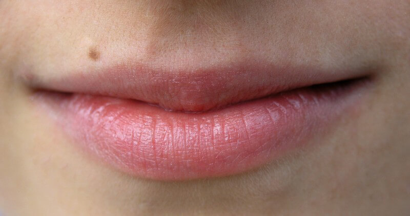 Wenn eine Lippenvergrößerung durch einen unerfahrenen Mediziner vorgenommen wird, kann es zu unangenehmen Komplikationen kommen