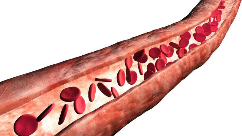 Eine Verletzung der Blutgefäße kann eine Minderversorgung der geschädigten Körperstelle sowie eine Thrombose zur Folge haben