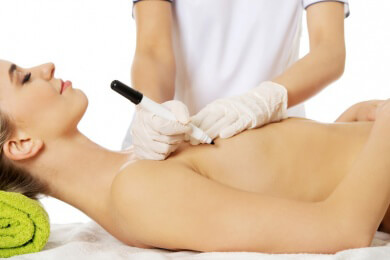 Operationsmethoden der Schlupfwarzenkorrektur - Bestehen Chancen auf Kostenübernahme?