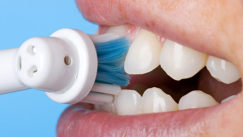 Über die Entstehung und Vermeidung von Zahnbelag und Nahrungsmittel, die schlecht für die Ästhetik der Zähne sind