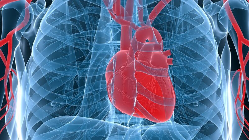 Man unterscheidet das akute sowie das chronische Cholesterinembolie-Syndrom