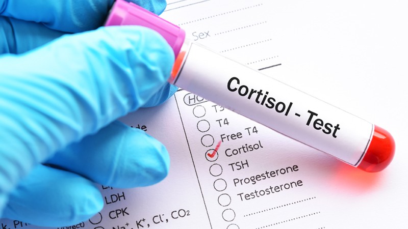 Blutprobe für Cortisol-Test