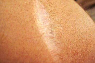 Camouflage-Make-up weist eine hohe Pigmentdichte auf und eignet sich hervorragend um Hautauffälligkeiten zu kaschieren