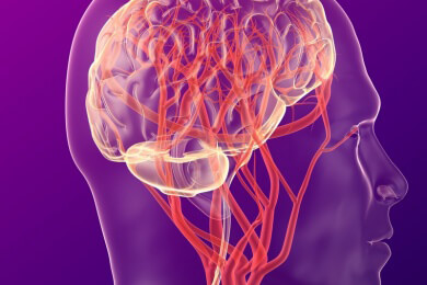Anwendung und Ablauf der funktionellen Magnetresonanztomographie