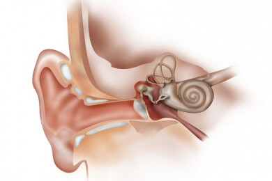 Gehörgangsentzündung - Ursachen, Symptome und Behandlung
