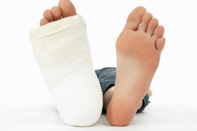 Beinbruch - Ursachen, Symptome, Behandlung und Vorbeugemöglichkeiten