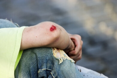 Aufgeschlagene Knie, Ellenbogen und  Co - Ursachen, Symptome und Behandlung von Schürfwunden