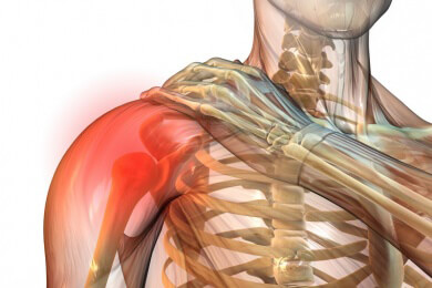 Schulterschutz - Merkmale, Funktion und Einsatzgebiete