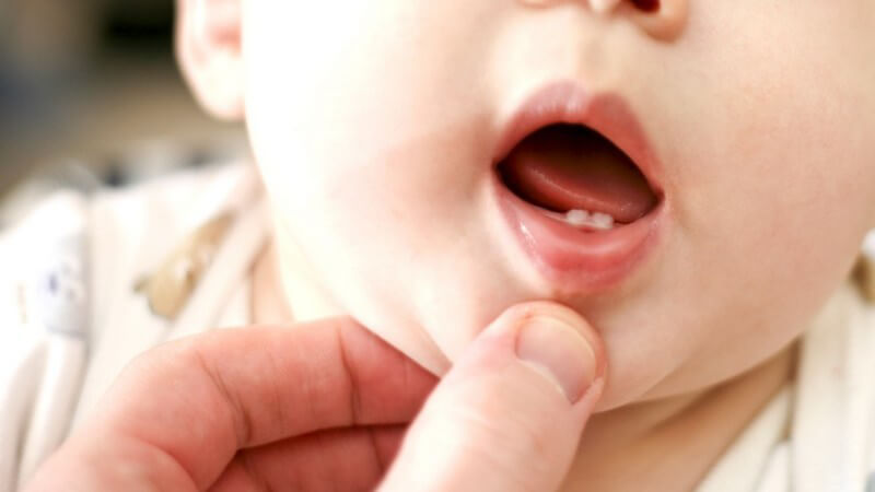 Eine beewusste Mundhygiene ist bereits wichtig, wenn die ersten Zähnchen durch das Zahnfleisch brechen