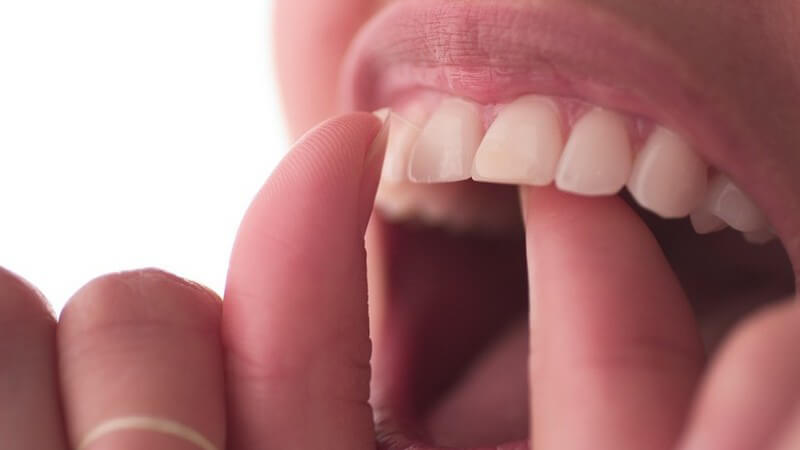 Wie Verfärbungen auf den Zähnen entstehen und wie man dagegen vorgeht