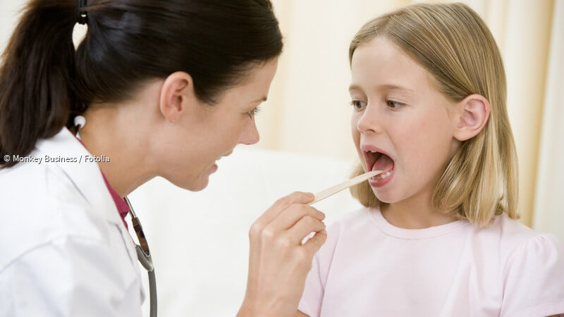 ᐅ Entstehung, Symptome und Behandlung einer Herpangina