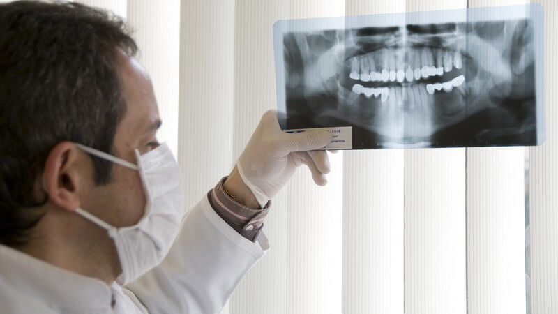Extraktionsmethoden und deren Anwendungsbereiche und Durchführung: Man kann den Zahn mittels Zange, Hebel oder Osteotomie ziehen