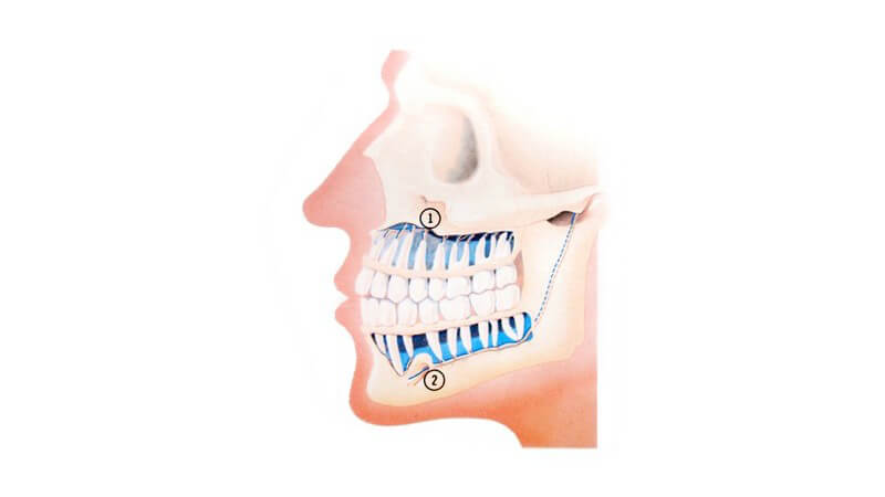 Beinhaltet die Entwicklung von Zahnknospe, festem Gewebe, Periodontium, Nerven und Gewebe