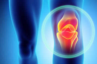 Arthrose - Ursachen, Symptome und Behandlung