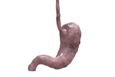 Gastritis - Ursachen, Symptome und Behandlung