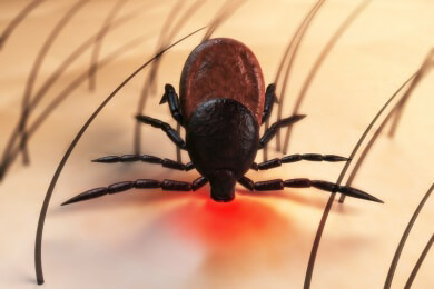 Borreliose - Ursachen, Symptome und Behandlung