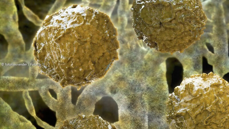 ᐅ Hyperplasie (übermäßige Zellbildung) Ursachen und Ausprägungsformen