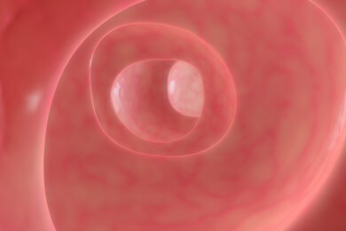 Morbus Crohn - Ursachen, Symptome und Diagnose