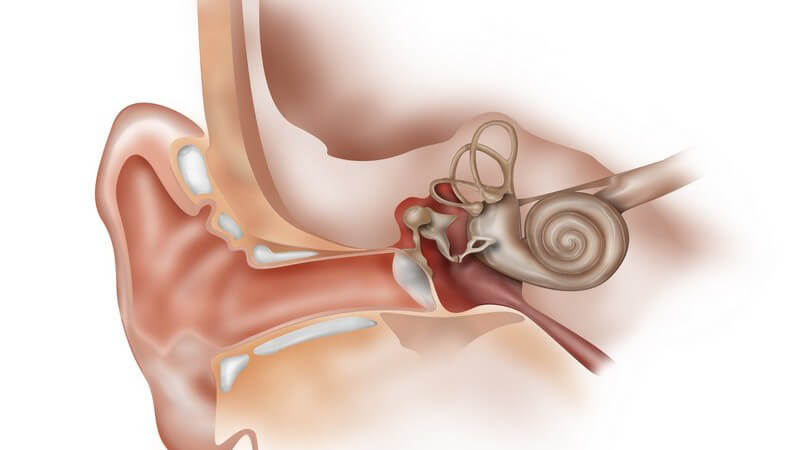 Als möglicher Auslöser gilt die vermehrte Ansammlung von Wasser im Gleichgewichts- und Hörorgan