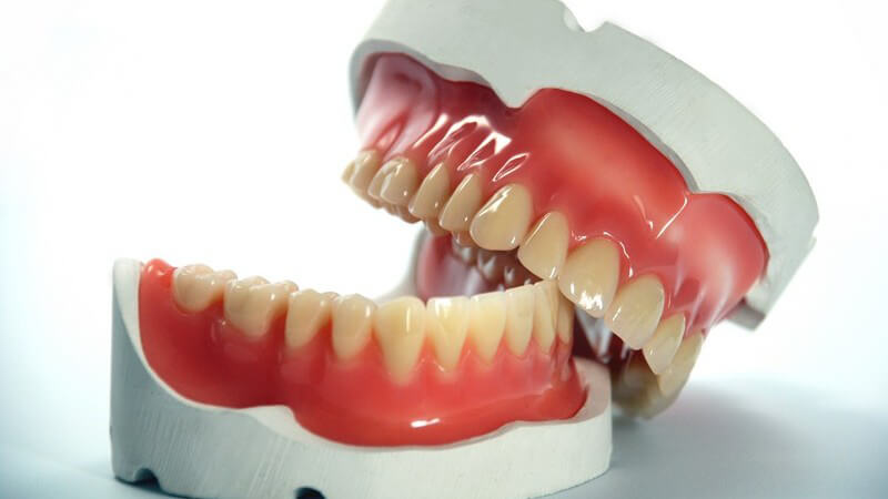Schätzungen zufolge leiden zwischen 15 und 20 Prozent aller Zahnarztpatienten unter einer Allergie gegen dentale Werkstoffe