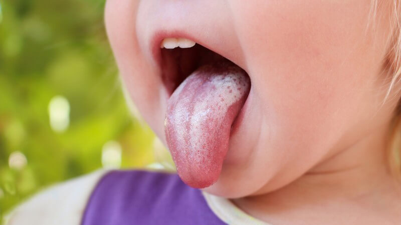 Je nach Form tritt die Kandidose an der Schleimhaut von Mund(röhre) und Vagina oder an inneren Organen auf