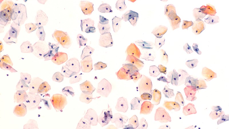 Mikroskopische Aufnahme zeigt Gebärmutterhalszellen