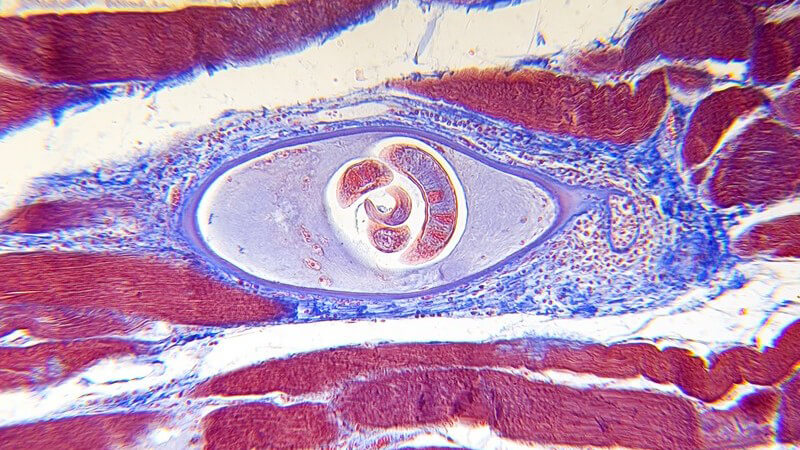 Allgemeine Informationen zu Fadenwürmern (Nematoden) und der Infektion beim Menschen