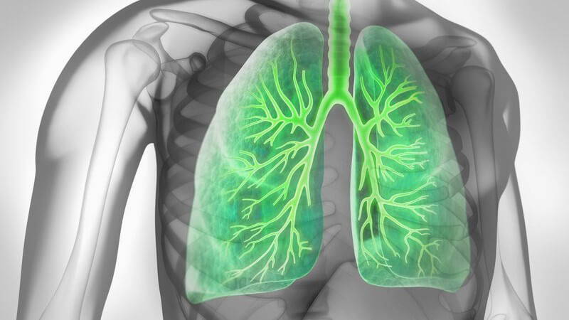 Schnell wachsendes und streuendes Lungenkarzinom
