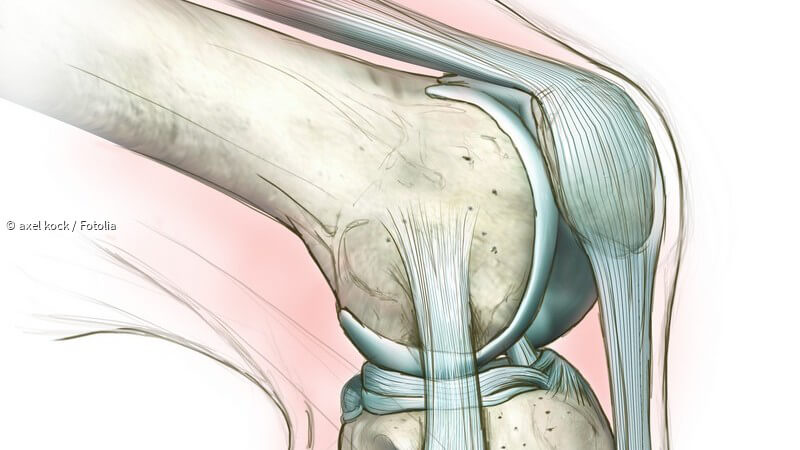 Außenbandriss Knie Außenbandriss Knie