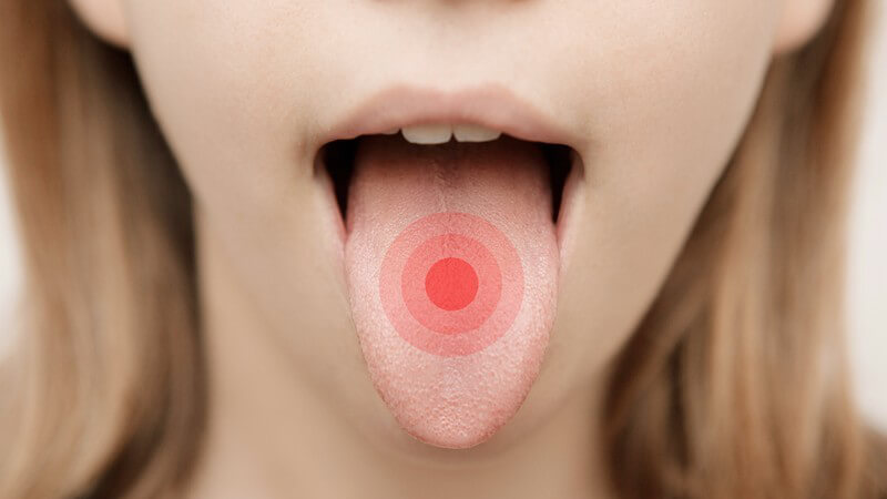 Was eine belegte Zunge über unsere Gesundheit verrät