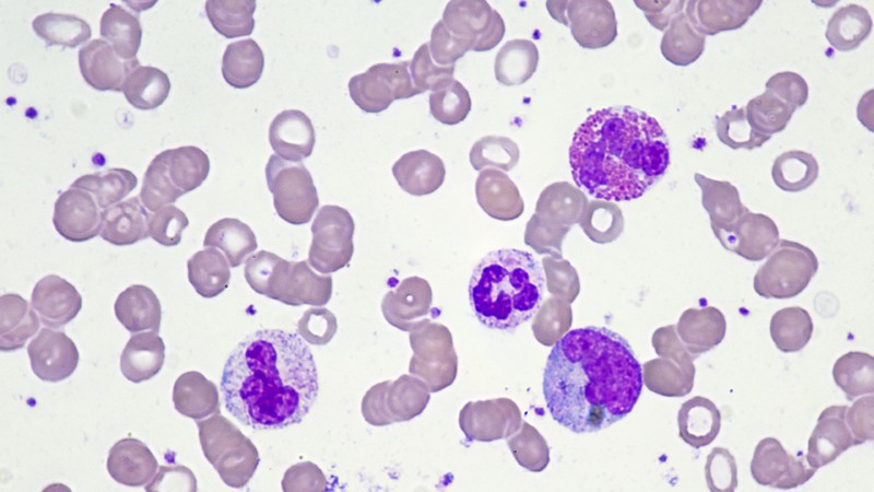 Weiße Blutzellen mit Neutrophilen Granulozyten, Monozyten und Eosinophilen Granulozyten