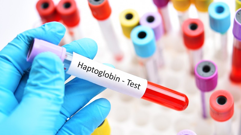 Blutprobe für Haptoglobin-Test