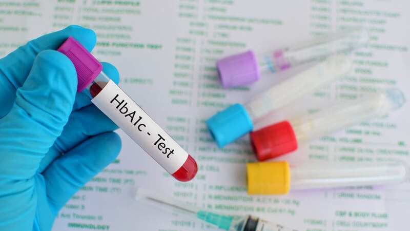 Der HbA1c-Wert ist ein wichtiger Laborwert bei Diabetes