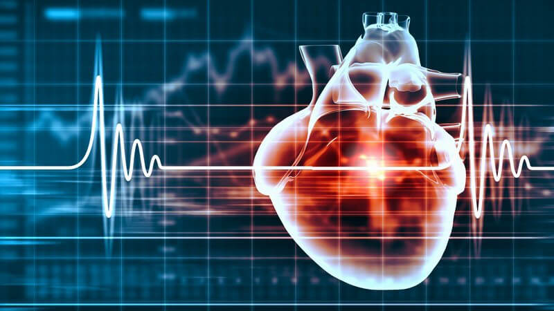 Wissenswertes zur ventrikulärer Fibrillation (VF)