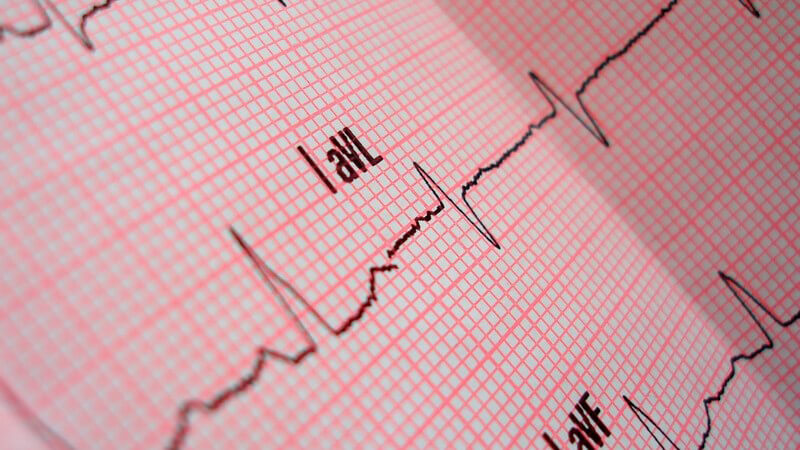 Vor allem Menschen über 50 Jahre sind von dem Sick-Sinus-Syndrom betroffen