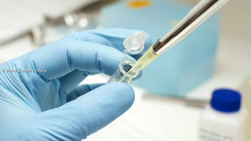 ᐅ Hämoccult-Test - Nutzen, Anwendungsgebiete und Ablauf