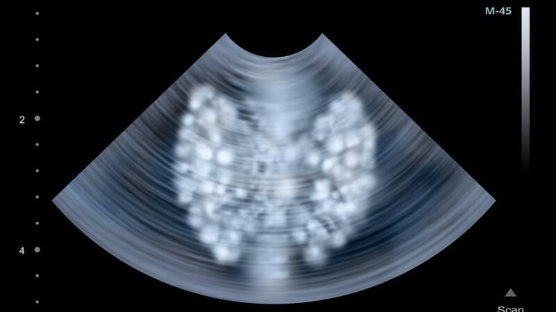 Wissenswertes zu den Hormonen Thyreoliberin und Thyreotropin