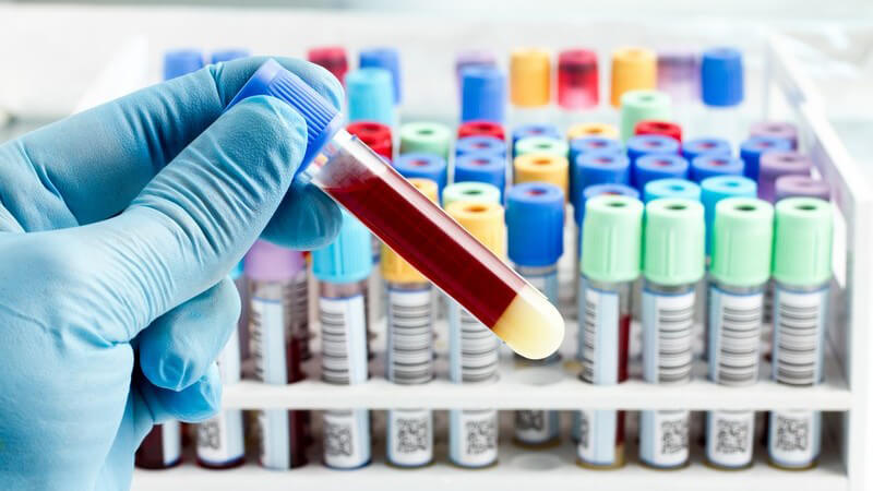 Die Erythrozytenparameter geben Aufschluss über die Funktionsfähigkeit der roten Blutkörperchen