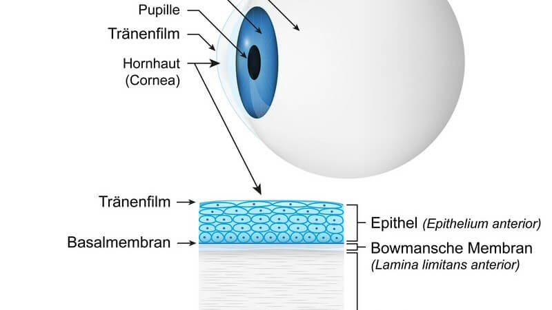 Wissenswertes zu torischen Kontaktlinsen bei Hornhautverkrümmung