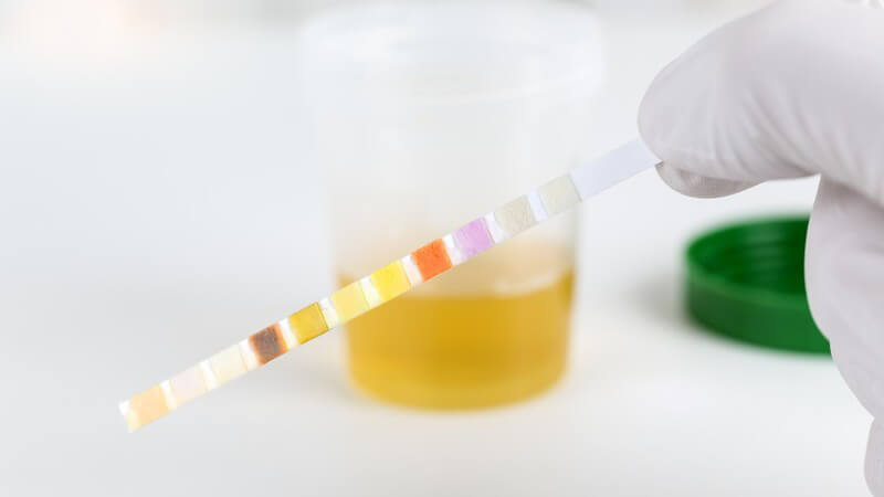 Urinteststreifen neben Urinprobe Urinteststreifen neben Urinprobe