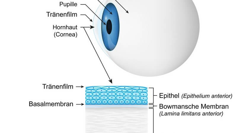 Wissenswertes zur Hornhauttransplantation