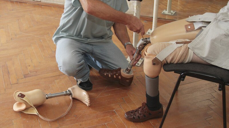 Wissenswertes zu Beinprothesen