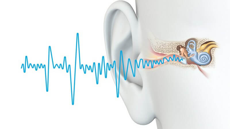 Das Cochlea-Implantat kann Menschen mit starken Hörstörungen wieder zum Hören verhelfen