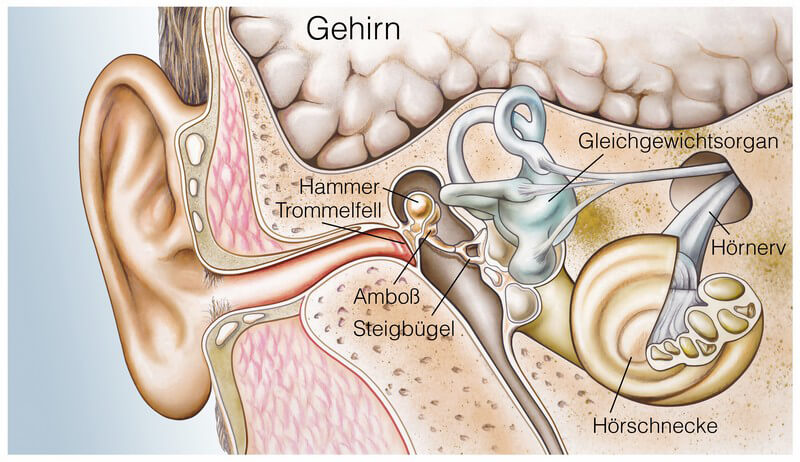Cochlea Implantat Hörprothese Für Gehörlose Und Schwerhörige