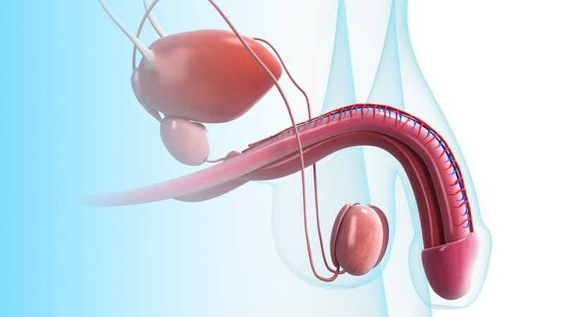 ᐅ Penisprothese - Schwellkörperimplantat bei Erektionsstörungen